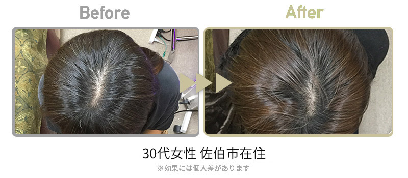 30代女性