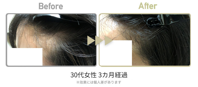 ビフォーアフター5