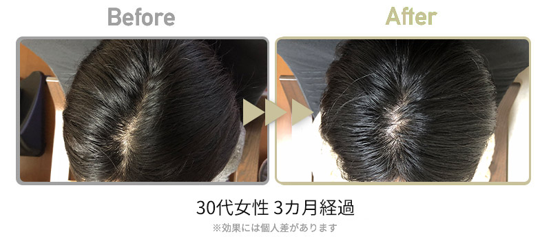 ビフォーアフター4