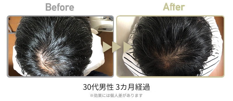 ビフォーアフター3