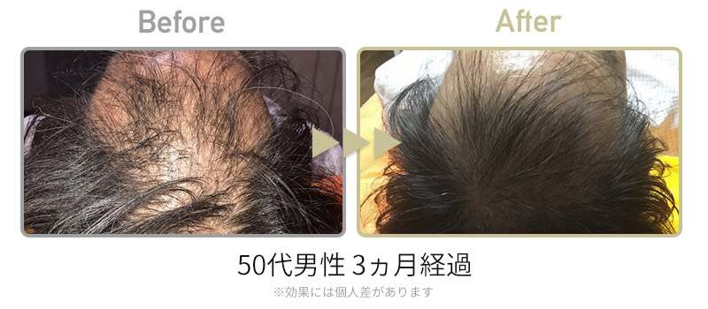 ビフォーアフター2