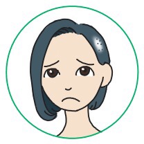 抜毛症