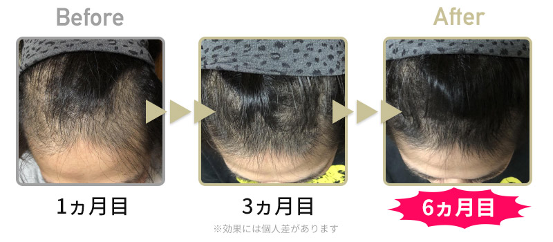 ビフォーアフター1